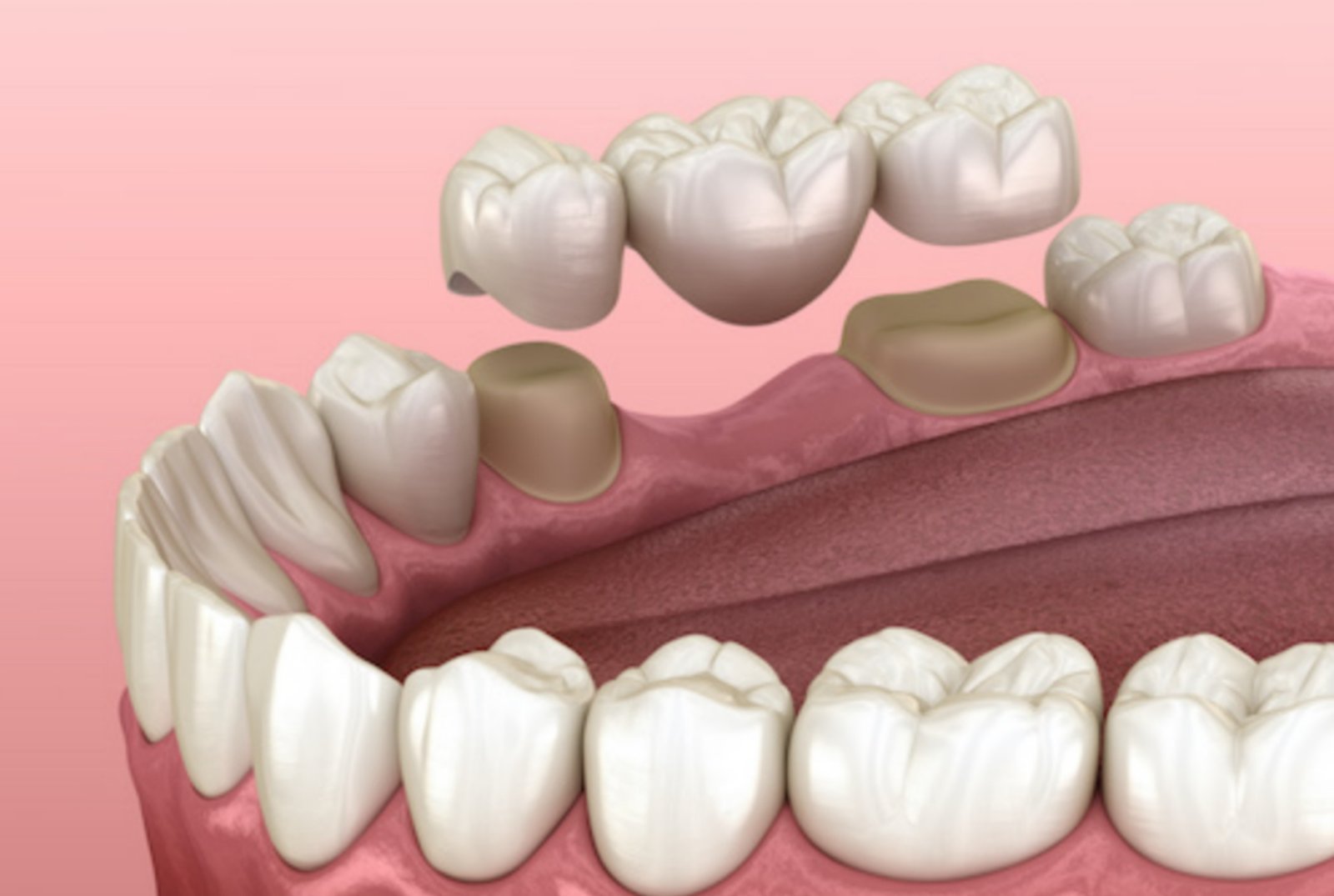 Prosthodontics